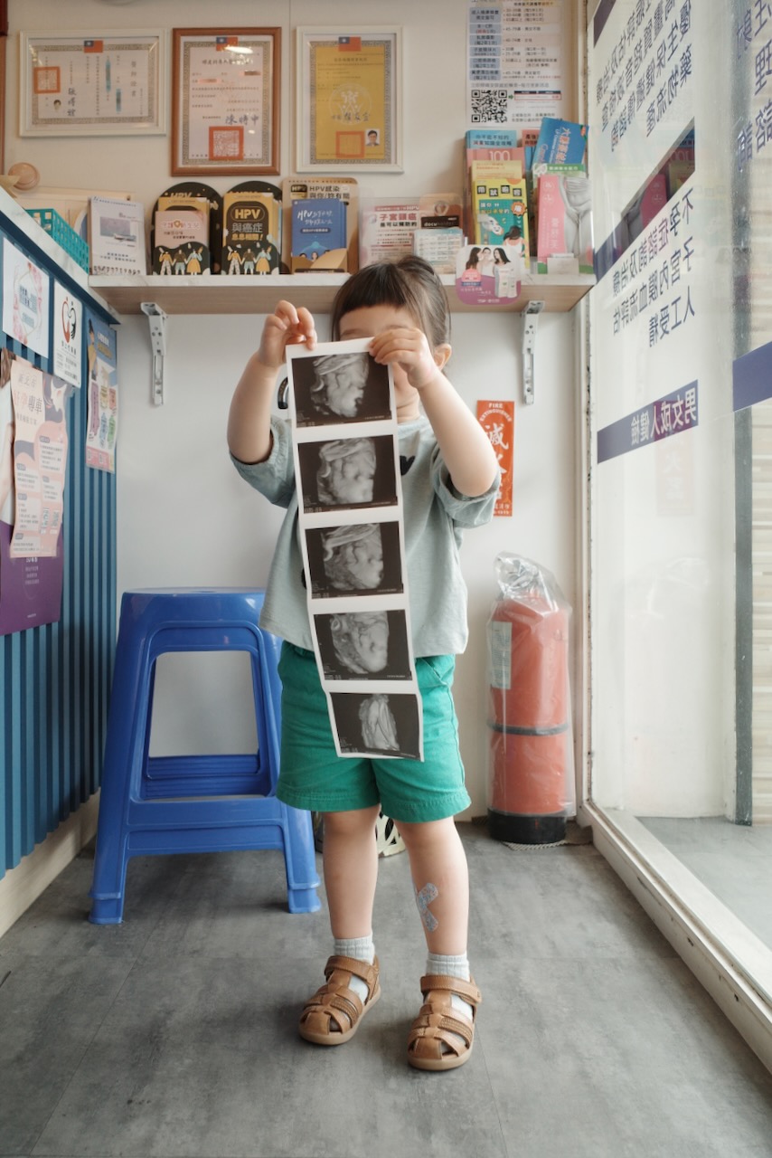 A toddler holding up the 3D scan photos of her future sibling
